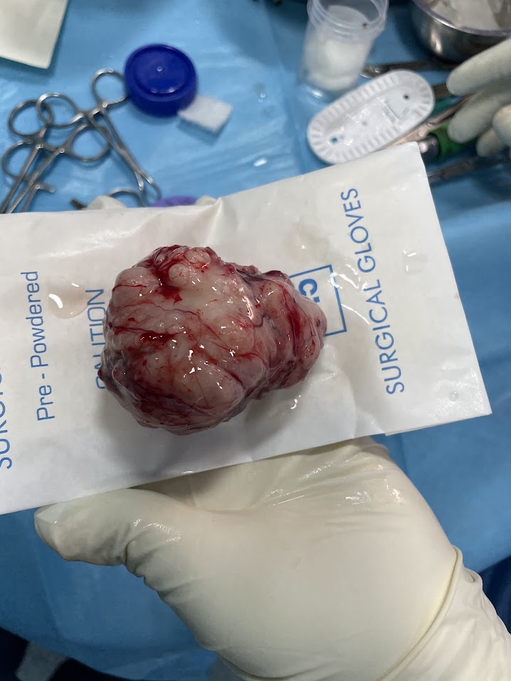 Minimally_invasive_surgery