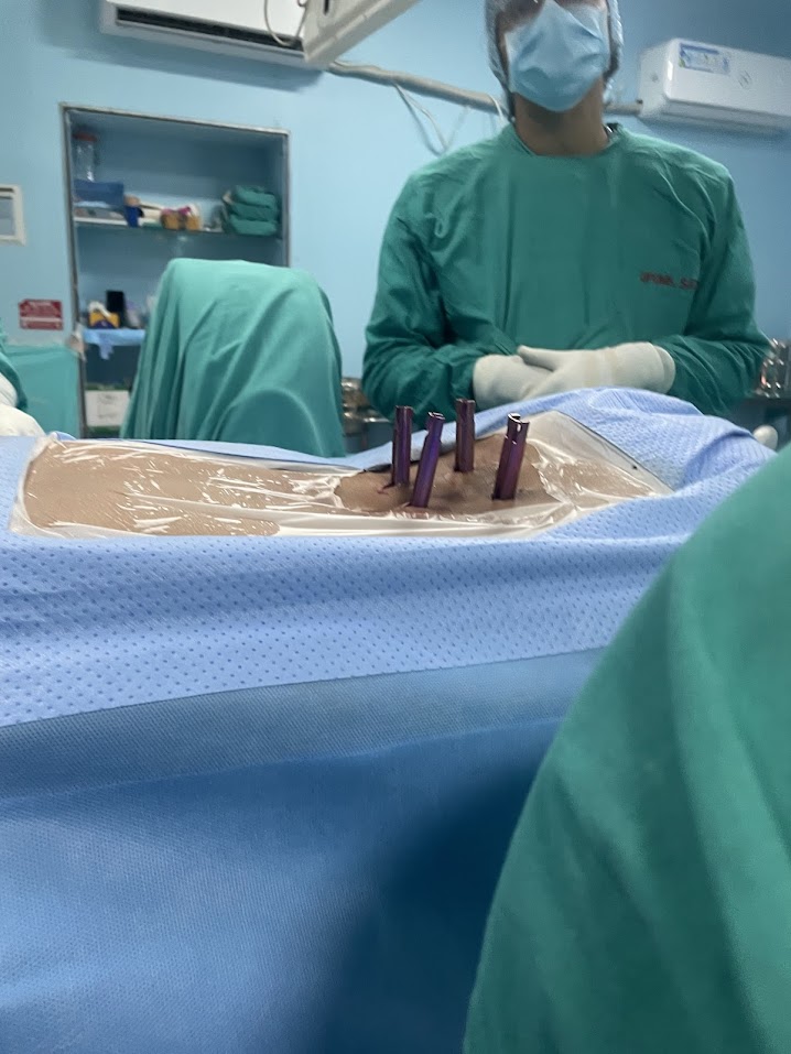 Conventional_open_spine_surgery
